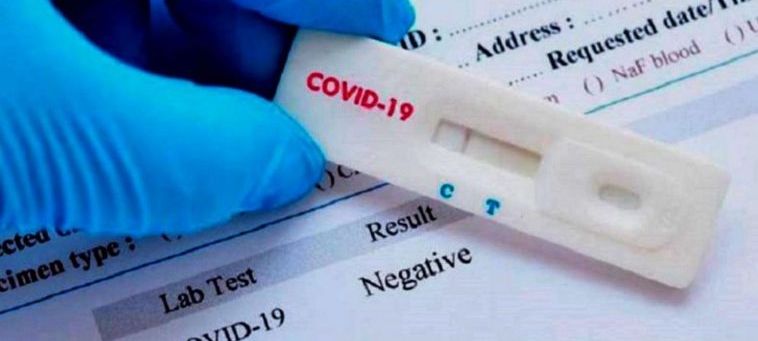 Sindicato/Faesp/Senar promovem testes gratuitos de Covid-19
