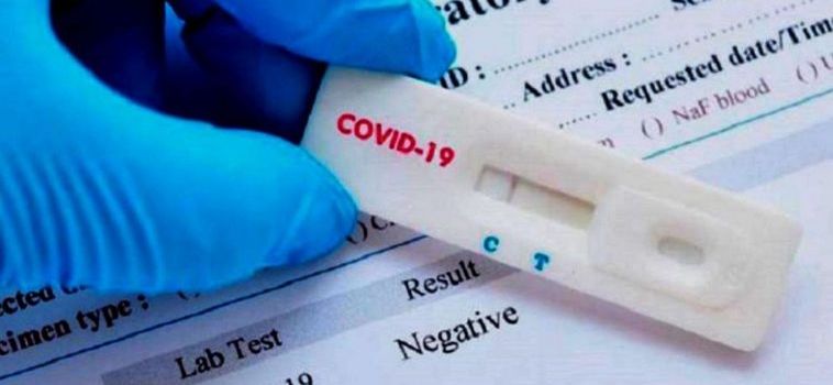 Nessa quarta-feira tem teste rpido de Covid-19 na Canania