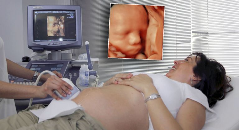 Clnica PilarMed j oferece ultrassom 4D, com imagem e som em tempo real do beb